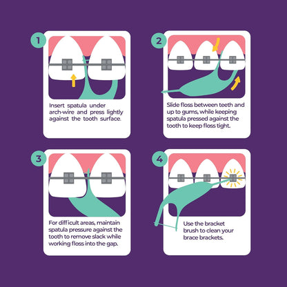 60 Pack: Platypus Orthodontic Floss Picks